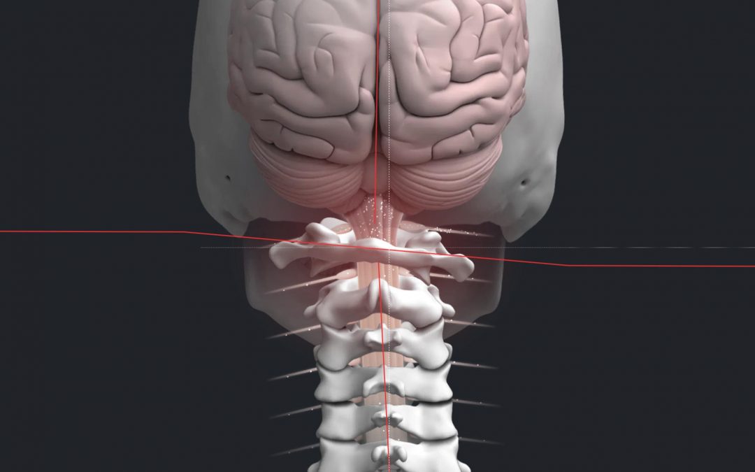 Upper Cervical Chiropractic Care vs Full Spine Chiropractic